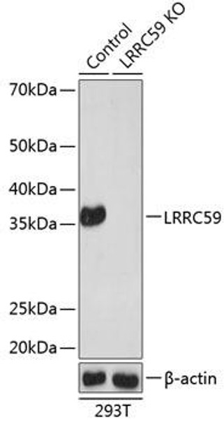 KO Validated Antibodies 2 Anti-LRRC59 Antibody CAB19965KO Validated