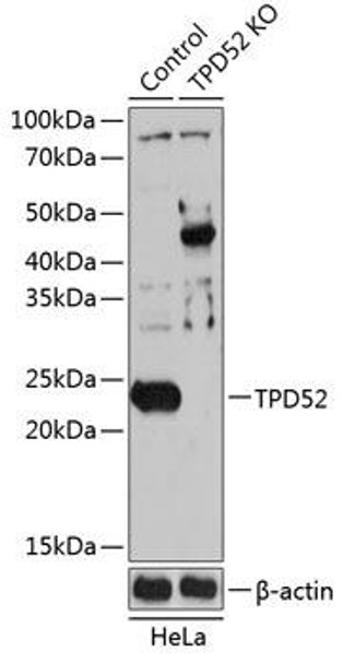 KO Validated Antibodies 2 Anti-TPD52 Antibody CAB19968KO Validated