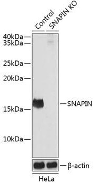 KO Validated Antibodies 2 Anti-SNAPIN Antibody CAB19980KO Validated
