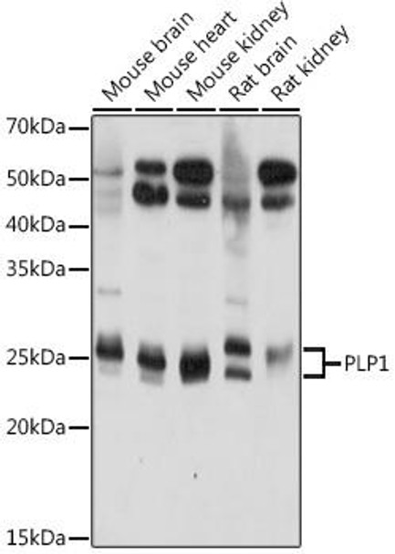 Neuroscience Anti-PLP1 Antibody CAB20009