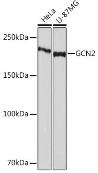 Immunology Antibodies 3 Anti-GCN2 Antibody CAB2307