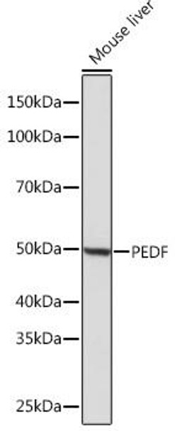 Cell Biology Antibodies 17 Anti-PEDF Antibody CAB3475