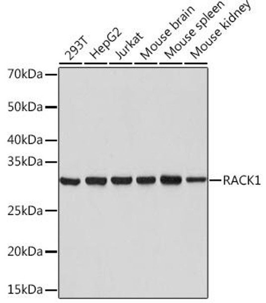 Cell Death Antibodies 2 Anti-RACK1 Antibody CAB3808