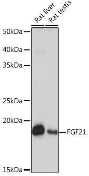 Cell Biology Antibodies 17 Anti-FGF21 Antibody CAB3908