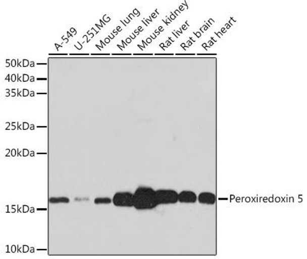 Cell Biology Antibodies 17 Anti-Peroxiredoxin 5 Antibody CAB3954