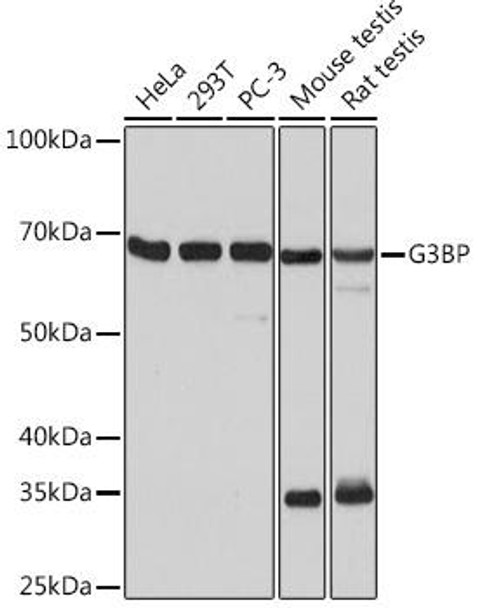 Immunology Antibodies 3 Anti-G3BP Antibody CAB3968