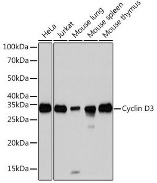 Cell Cycle Antibodies 2 Anti-Cyclin D3 Antibody CAB3989