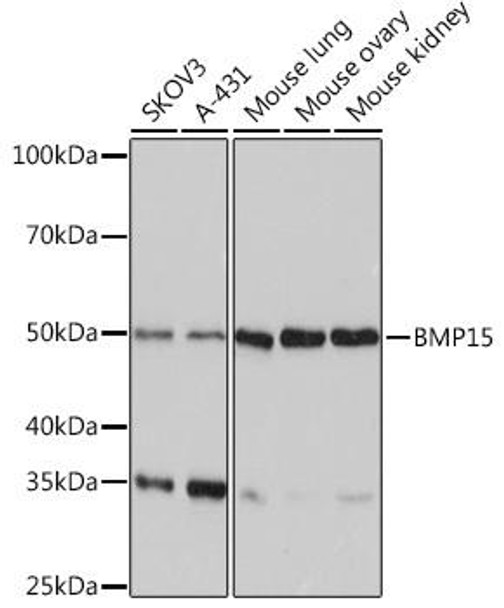 Cell Biology Antibodies 17 Anti-BMP15 Antibody CAB4148