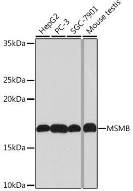 Cell Biology Antibodies 17 Anti-MSMB Antibody CAB4168