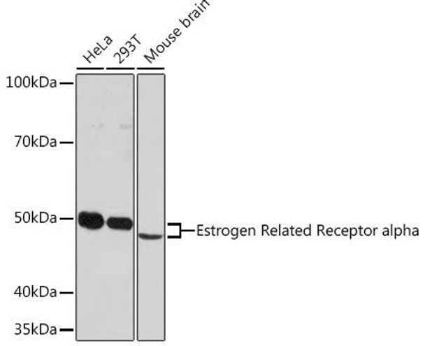 Epigenetics and Nuclear Signaling Antibodies 5 Anti-Estrogen Related Receptor alpha Antibody CAB4176