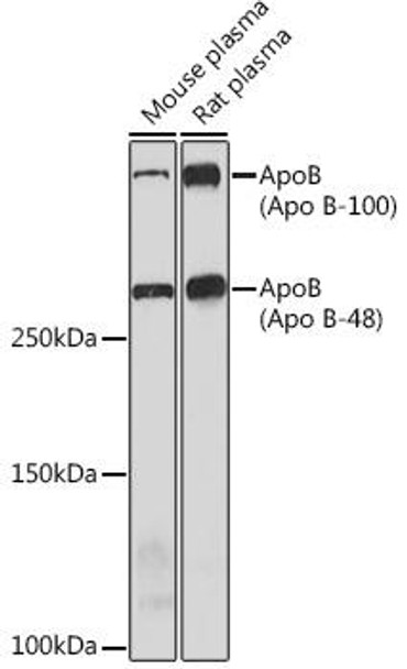 Metabolism Antibodies 3 Anti-ApoB Antibody CAB4184