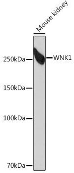 Cell Biology Antibodies 17 Anti-WNK1 Antibody CAB4223