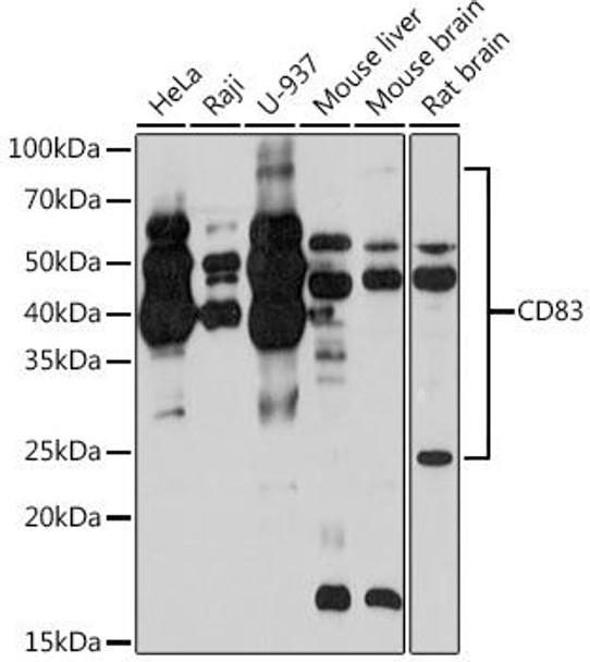 Cell Biology Antibodies 17 Anti-CD83 Antibody CAB4234