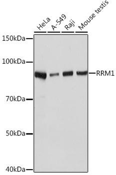 Epigenetics and Nuclear Signaling Antibodies 5 Anti-RRM1 Antibody CAB4259