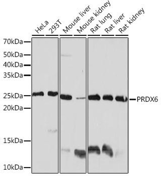 Metabolism Antibodies 3 Anti-PRDX6 Antibody CAB4286