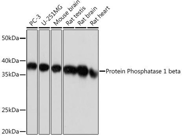 Cell Biology Antibodies 17 Anti-Protein Phosphatase 1 beta Antibody CAB4364