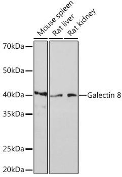 Autophagy Antibodies Anti-Galectin 8 Antibody CAB4383