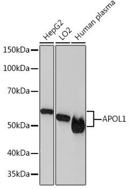 Metabolism Antibodies 3 Anti-APOL1 Antibody CAB4412