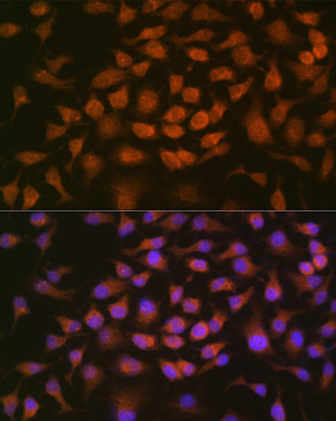 KO Validated Antibodies 2 Anti-GRK2 KO Validated Antibody CAB4443