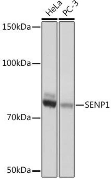 Signal Transduction Antibodies 3 Anti-SENP1 Antibody CAB4460