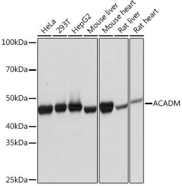 Metabolism Antibodies 3 Anti-ACADM Antibody CAB4567