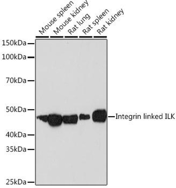 Cell Biology Antibodies 17 Anti-Integrin linked ILK Antibody CAB4571