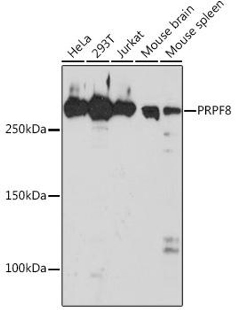 Epigenetics and Nuclear Signaling Antibodies 5 Anti-PRPF8 Antibody CAB4575