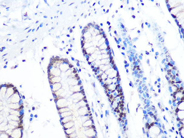 KO Validated Antibodies 2 Anti-MTA2 KO Validated Antibody CAB4624