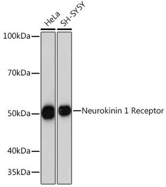 Cell Biology Antibodies 17 Anti-Neurokinin 1 Receptor Antibody CAB4676