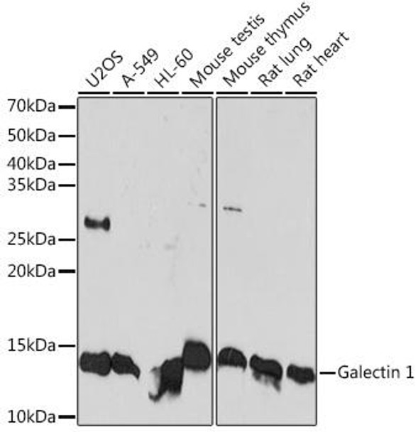 Cell Death Antibodies 2 Anti-Galectin 1 Antibody CAB4732