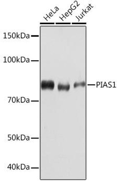 Epigenetics and Nuclear Signaling Antibodies 5 Anti-PIAS1 Antibody CAB4744