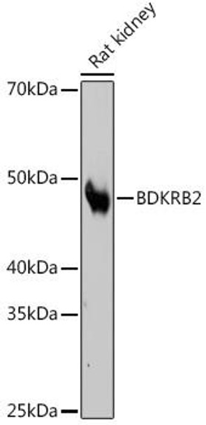 Cell Biology Antibodies 17 Anti-BDKRB2 Antibody CAB4756