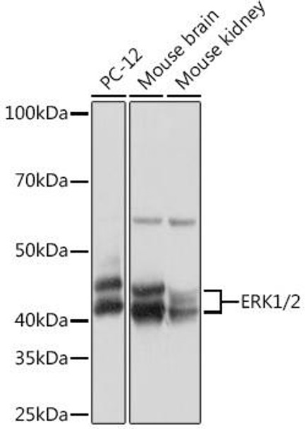 Cell Biology Antibodies 17 Anti-ERK1/2 Antibody CAB4782