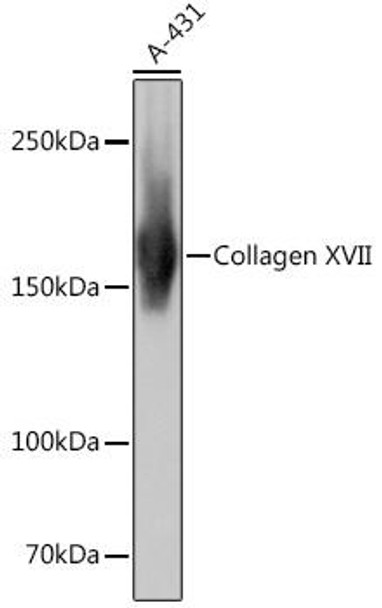 Cell Biology Antibodies 17 Anti-Collagen XVII Antibody CAB4808