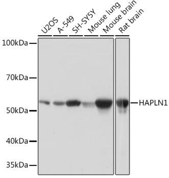 Cell Biology Antibodies 17 Anti-HAPLN1 Antibody CAB4815