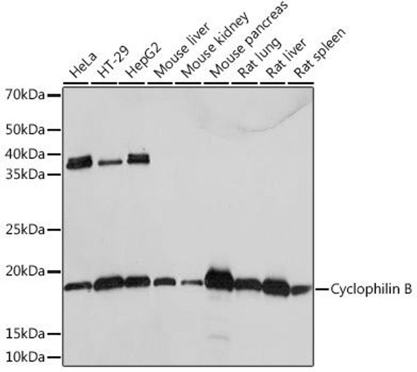 Cell Biology Antibodies 17 Anti-Cyclophilin B Antibody CAB4861