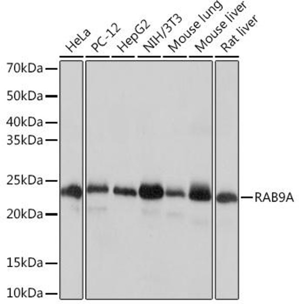 Cell Biology Antibodies 17 Anti-RAB9A Antibody CAB4894