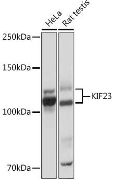 Cell Cycle Antibodies 2 Anti-KIF23 Antibody CAB4896
