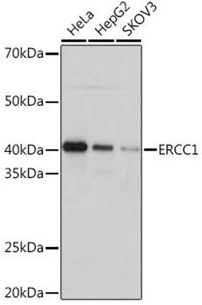 Epigenetics and Nuclear Signaling Antibodies 5 Anti-ERCC1 Antibody CAB4971