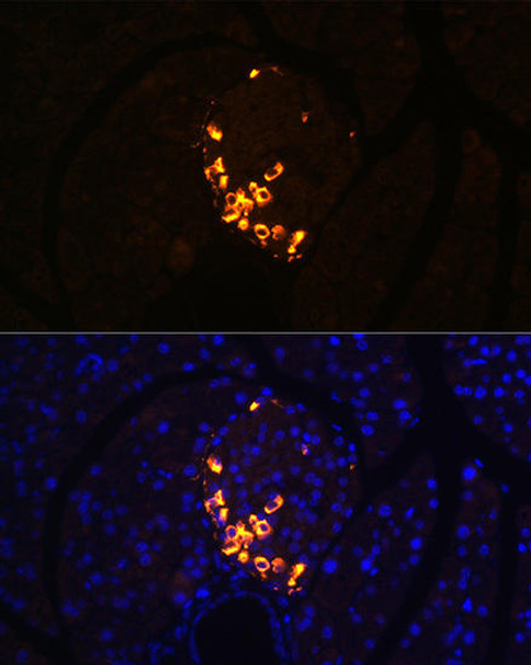 Cell Biology Antibodies 17 Anti-GLP2 Antibody CAB5009