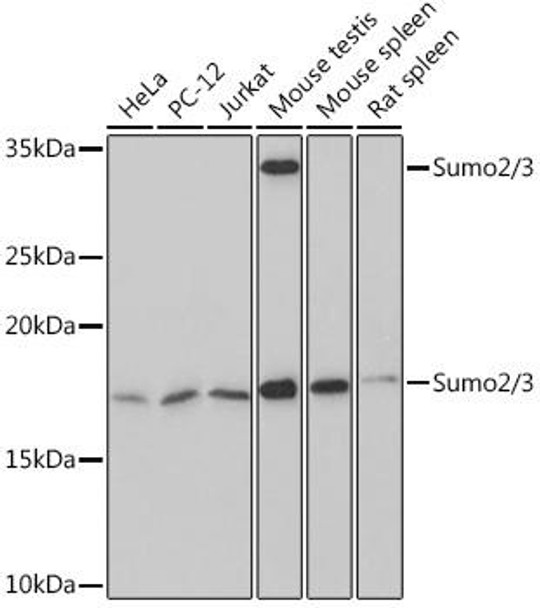 Cell Biology Antibodies 15 Anti-Sumo2/3 Antibody CAB5066