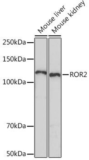 Metabolism Antibodies 3 Anti-ROR2 Antibody CAB5120