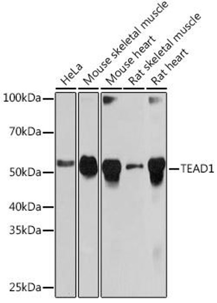 Epigenetics and Nuclear Signaling Antibodies 5 Anti-TEAD1 Antibody CAB5218