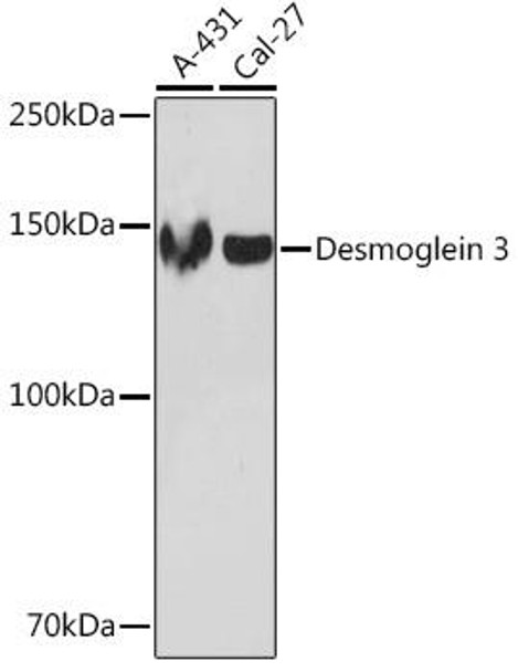 Cell Biology Antibodies 17 Anti-Desmoglein 3 Antibody CAB5227