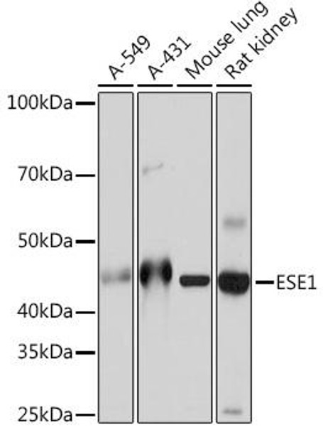 Developmental Biology Anti-ESE1 Antibody CAB5236