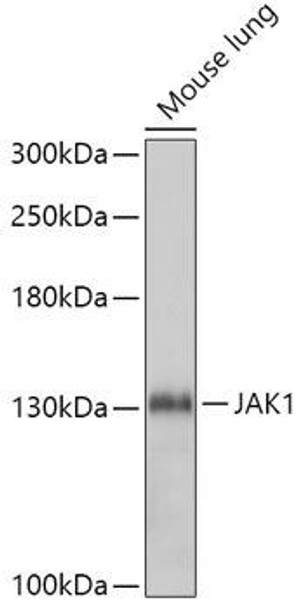 Cell Biology Antibodies 17 Anti-JAK1 Antibody CAB5534