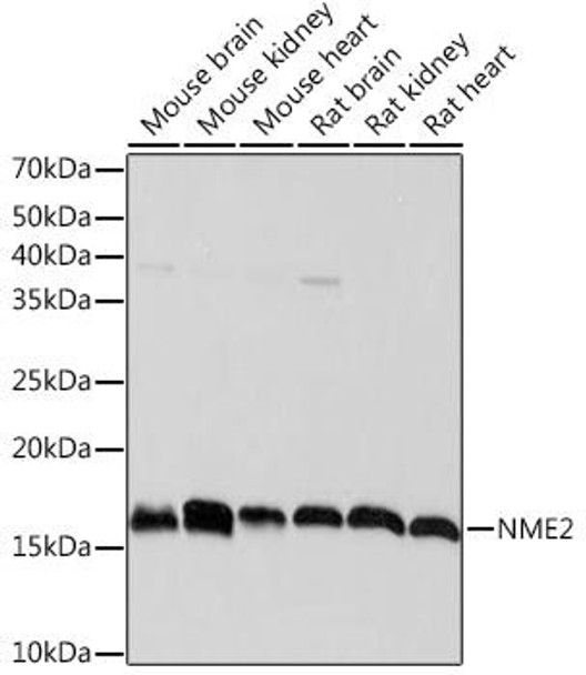 Metabolism Antibodies 3 Anti-NME2 Antibody CAB5621