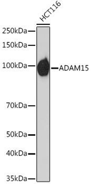 Cardiovascular Antibodies Anti-ADAM15 Antibody CAB6813