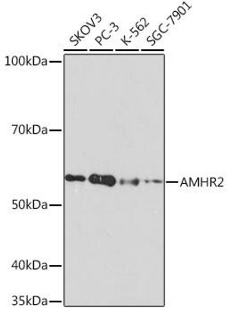 Cell Biology Antibodies 17 Anti-AMHR2 Antibody CAB8813