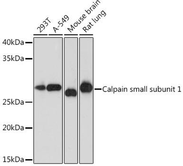 Cell Biology Antibodies 17 Anti-Calpain small subunit 1 Antibody CAB8859
